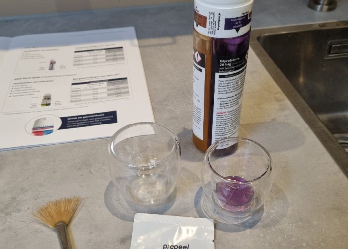 Chemische peeling behandeling